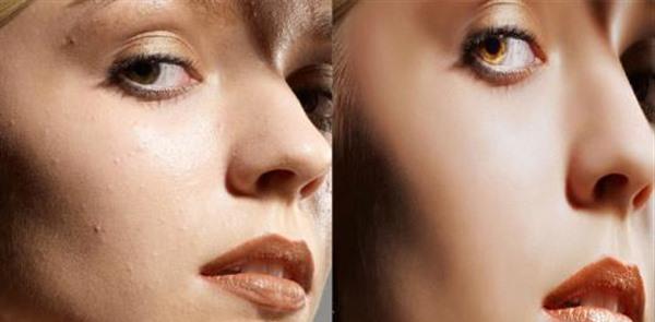 微晶磨皮<a href=http://www.mx185.com/listinfo-782-0.html target=_blank class=infotextkey>去眼角细纹</a>治疗方式是什么?