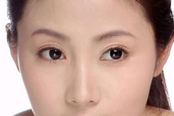 做<a href=http://www.mx185.com/listinfo-724-0.html target=_blank class=infotextkey>双眼皮</a>重睑术有什么危害 重睑术有哪些治疗方法