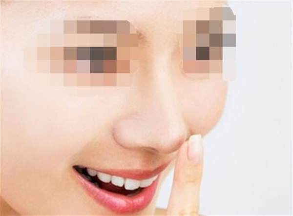 自体脂肪<a href=http://www.mx185.com/listinfo-737-0.html target=_blank class=infotextkey>隆鼻</a>的缺点有哪些