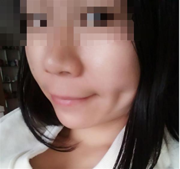 <a href=http://www.mx185.com/listinfo-637-0.html target=_blank class=infotextkey>酒窝整形</a>多少钱术后如何护理