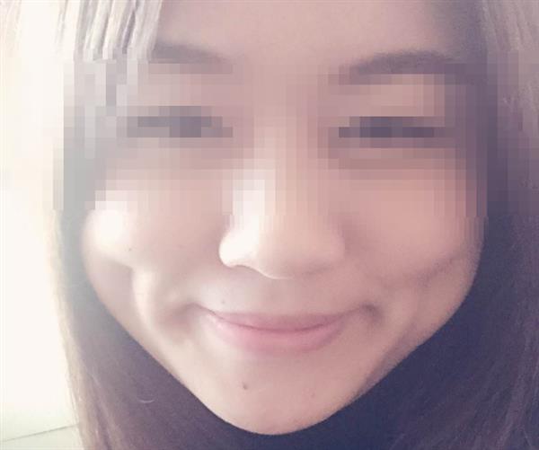 <a href=http://www.mx185.com/listinfo-637-0.html target=_blank class=infotextkey>酒窝整形</a>多少钱及术后护理