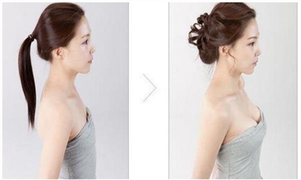 韩式注射<a href=http://www.mx185.com/listinfo-618-0.html target=_blank class=infotextkey>隆胸</a>怎么样