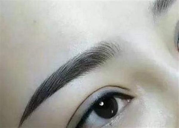 纹美瞳线肿了怎样消肿