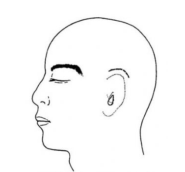 全耳再造术有哪些方法啊