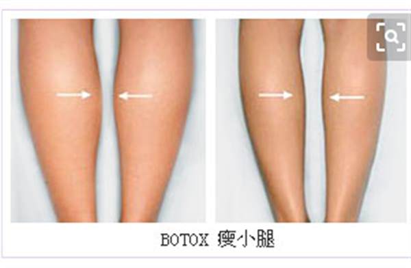 怎样<a href=http://www.mx185.com/listinfo-679-0.html target=_blank class=infotextkey>瘦小腿</a>有效