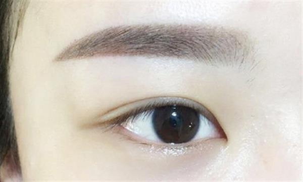 眼袋抽脂眼袋抽脂术多少钱