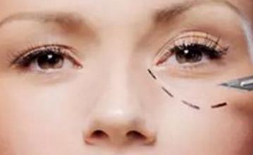 眼袋抽脂手术特点及方法您知道吗