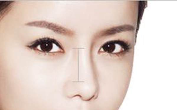 注射透明质酸<a href=http://www.mx185.com/listinfo-737-0.html target=_blank class=infotextkey>隆鼻</a>术前注意事项