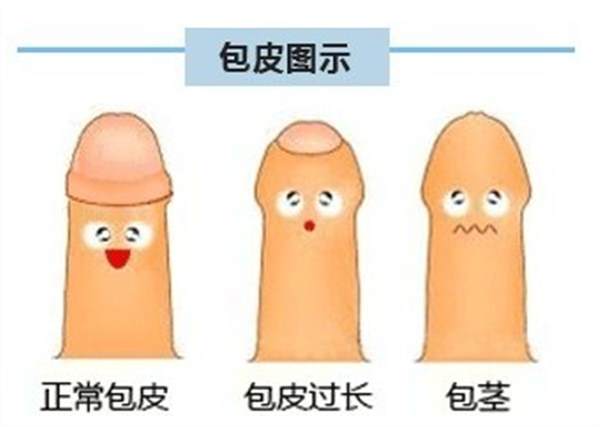 包皮过长有什么危害