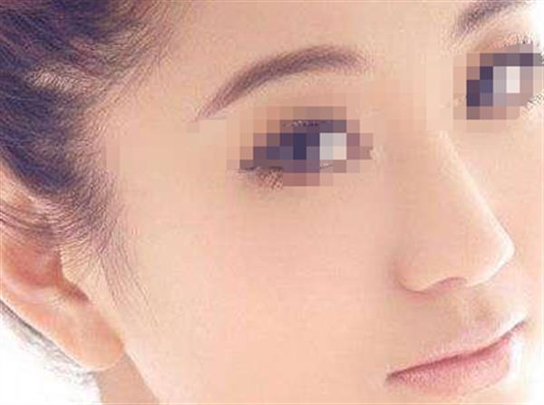 解析光子<a href=http://www.mx185.com/listinfo-770-0.html target=_blank class=infotextkey>嫩肤</a>术