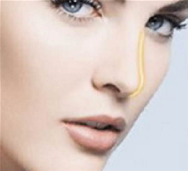 有什么<a href=http://www.mx185.com/listinfo-757-0.html target=_blank class=infotextkey>鼻尖</a>矫正的方法？