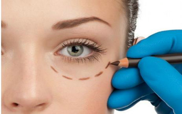 内切祛眼袋有后遗症么?