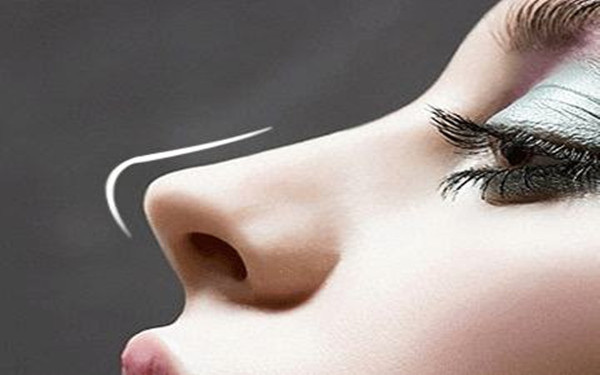 做鼻子多久恢复