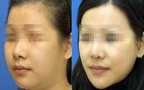 该如何<a href=http://www.mx185.com/listinfo-631-0.html target=_blank class=infotextkey>瘦脸</a>