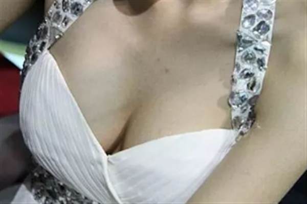 乳晕漂红需要哪些准备