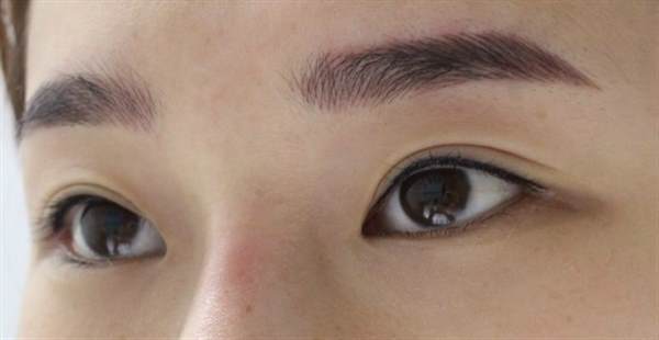 <a href=http://www.mx185.com/listinfo-714-0.html target=_blank class=infotextkey>纹眼线</a>眼睛肿了怎么办