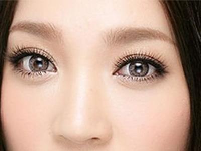 <a href=http://www.mx185.com/listinfo-682-0.html target=_blank class=infotextkey>溶脂</a><a href=http://www.mx185.com/listinfo-708-0.html target=_blank class=infotextkey>去眼袋</a>好不好呢