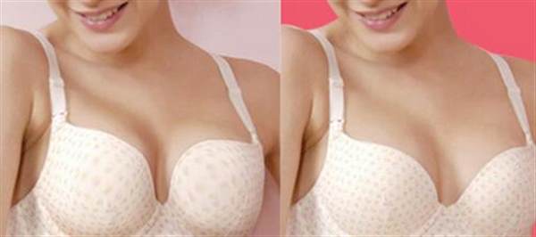 自体脂肪<a href=http://www.mx185.com/listinfo-618-0.html target=_blank class=infotextkey>隆胸</a>多少钱