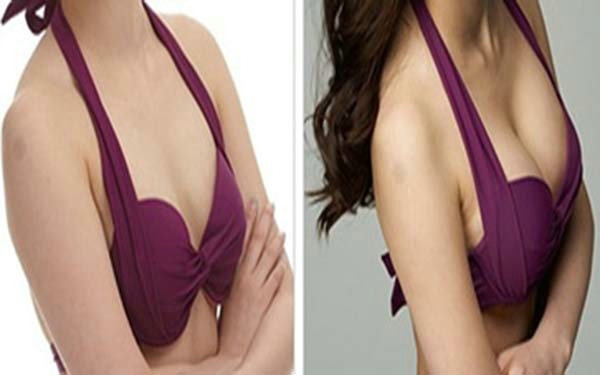 假体<a href=http://www.mx185.com/listinfo-618-0.html target=_blank class=infotextkey>隆胸</a>有哪些优势