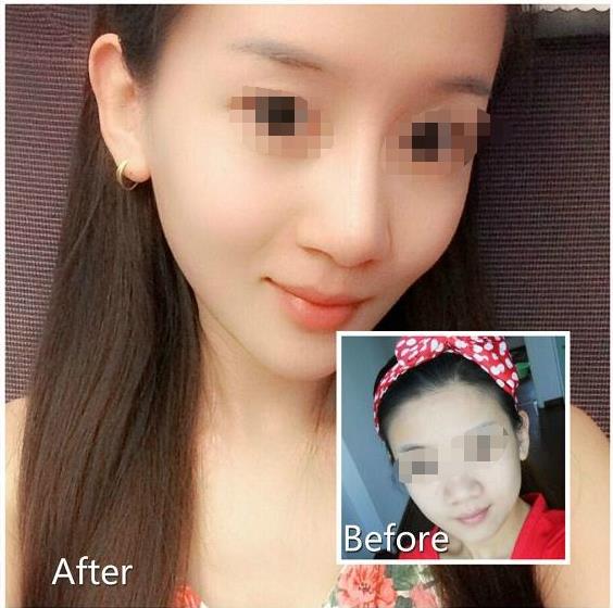 打<a href=http://www.mx185.com/listinfo-631-0.html target=_blank class=infotextkey>瘦脸</a><a href=http://www.mx185.com/listinfo-614-0.html target=_blank class=infotextkey>除皱</a>可以喝酒吗