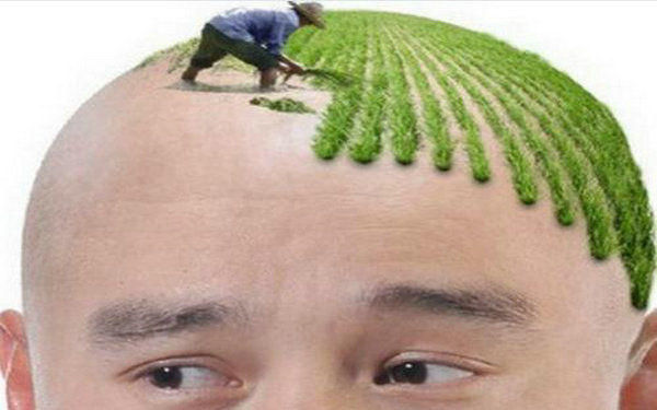种植头发是怎么种的？