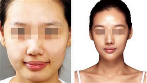 <a href=http://www.mx185.com/listinfo-631-0.html target=_blank class=infotextkey>瘦脸</a><a href=http://www.mx185.com/listinfo-614-0.html target=_blank class=infotextkey>除皱</a>多少钱