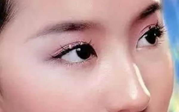微创点压式<a href=http://www.mx185.com/listinfo-724-0.html target=_blank class=infotextkey>双眼皮</a>手术费用是多少