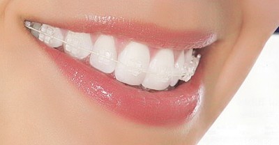 3d<a href=http://www.mx185.com/listinfo-830-0.html target=_blank class=infotextkey>美容冠</a>多少钱