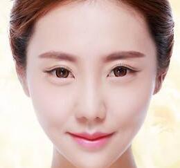 丰面颊术后注意事项