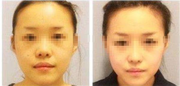 方脸瘦下来成什么样子