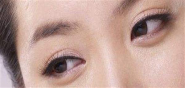 眼皮打透明质酸可以打成<a href=http://www.mx185.com/listinfo-724-0.html target=_blank class=infotextkey>双眼皮</a>吗