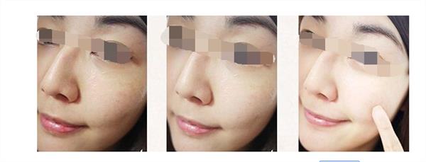 彩光<a href=http://www.mx185.com/listinfo-770-0.html target=_blank class=infotextkey>嫩肤</a>术后需要注意哪些事项呢