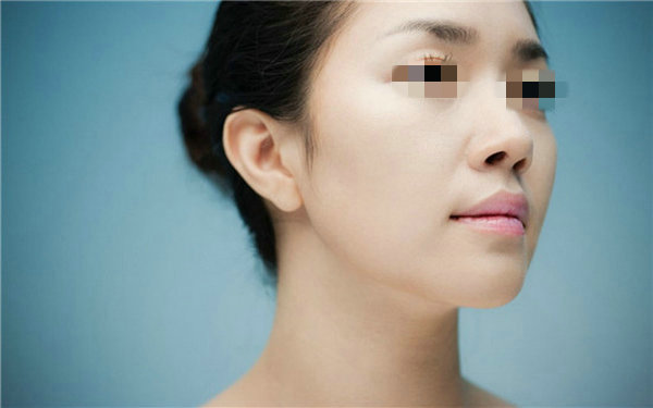 做假体<a href=http://www.mx185.com/listinfo-737-0.html target=_blank class=infotextkey>隆鼻</a>手术多少钱？