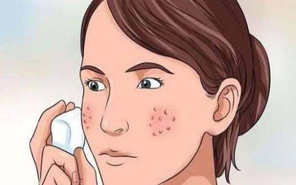 透明质酸真能去痘印吗