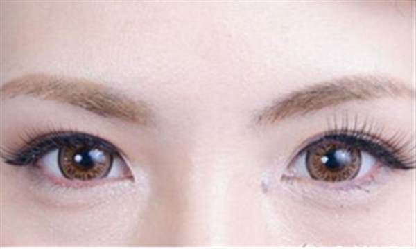 透明质酸填充<a href=http://www.mx185.com/listinfo-722-0.html target=_blank class=infotextkey>卧蚕</a>多少钱
