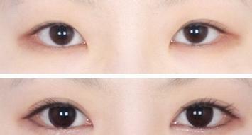 <a href=http://www.mx185.com/listinfo-711-0.html target=_blank class=infotextkey>开眼角</a>失败修复怎么做