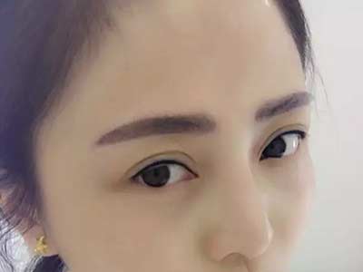 <a href=http://www.mx185.com/listinfo-714-0.html target=_blank class=infotextkey>纹眼线</a>眼睛一般肿几天