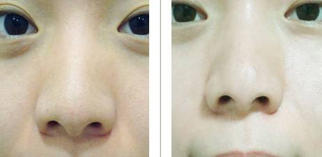 做彩光<a href=http://www.mx185.com/listinfo-770-0.html target=_blank class=infotextkey>嫩肤</a>要多少钱