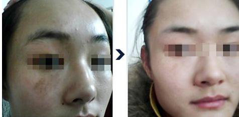 <a href=http://www.mx185.com/listinfo-795-0.html target=_blank class=infotextkey>祛斑</a>较好的方法