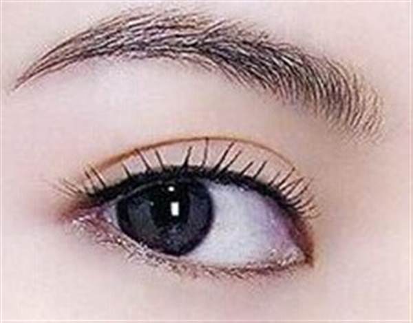 全切<a href=http://www.mx185.com/listinfo-724-0.html target=_blank class=infotextkey>双眼皮</a>手术是什么