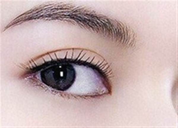 全切<a href=http://www.mx185.com/listinfo-724-0.html target=_blank class=infotextkey>双眼皮</a>手术是什么意思