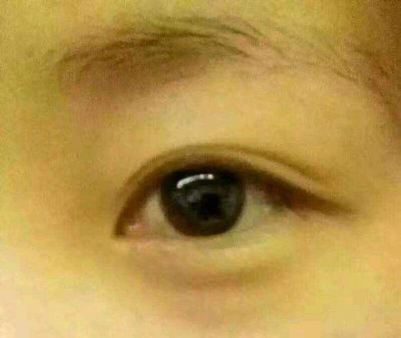 韩式埋线<a href=http://www.mx185.com/listinfo-724-0.html target=_blank class=infotextkey>双眼皮</a>多少钱