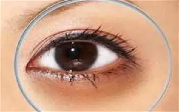 全切<a href=http://www.mx185.com/listinfo-724-0.html target=_blank class=infotextkey>双眼皮</a>手术术后怎么护理