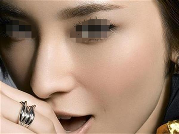 打透明质酸<a href=http://www.mx185.com/listinfo-737-0.html target=_blank class=infotextkey>隆鼻</a>能维持多久