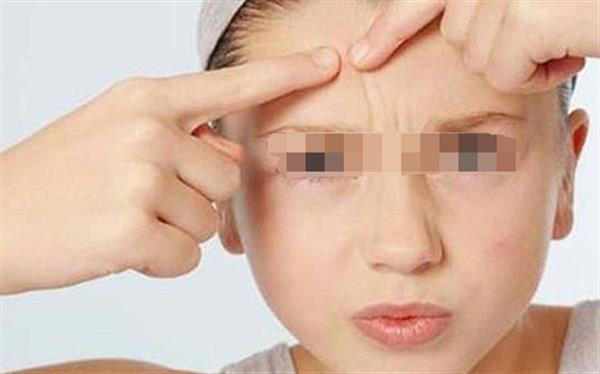 脸上有痘印怎么去除