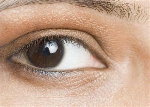 眼台修复的正确方法