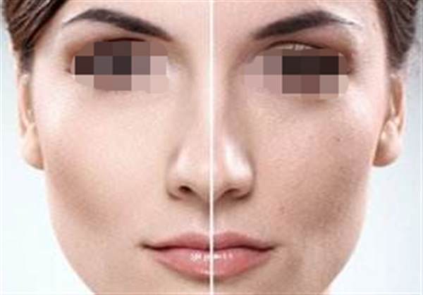 彩光<a href=http://www.mx185.com/listinfo-770-0.html target=_blank class=infotextkey>嫩肤</a>后的注意事项有哪些