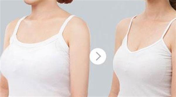 是否适合作乳房缩小整形