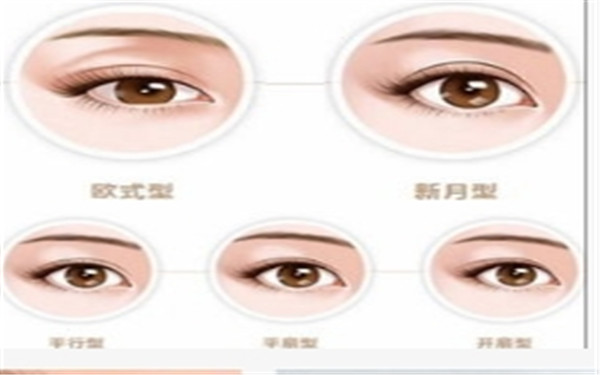  <a href=http://www.mx185.com/listinfo-724-0.html target=_blank class=infotextkey>双眼皮</a>修复有哪些原则
