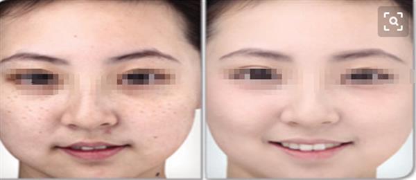 什么样的皮肤问题适合做光子<a href=http://www.mx185.com/listinfo-770-0.html target=_blank class=infotextkey>嫩肤</a>